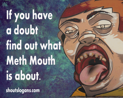 meth-mouth-posters